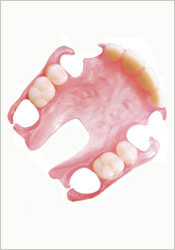 valplast-flexible-partial-dentures